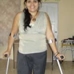 Anita with 2 prostheses