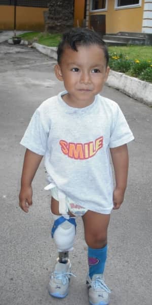 Miguel can walk, run and jump with his prosthesis that he received at age 3