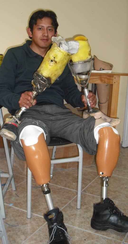 Young man holds his 10 year old prostheses that he welded together, now wearing his new prostheses